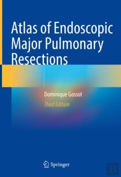 Bertrand.pt - Atlas Of Endoscopic Major Pulmonary Resections