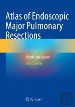 Atlas Of Endoscopic Major Pulmonary Resections