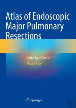 Bertrand.pt - Atlas Of Endoscopic Major Pulmonary Resections