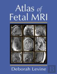 Atlas Of Fetal Mri