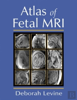 Bertrand.pt - Atlas Of Fetal Mri
