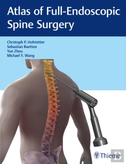 Bertrand.pt - Atlas Of Full-Endoscopic Spine Surgery