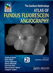 Atlas Of Fundus Fluorescein Angiography