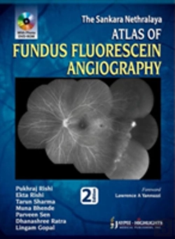 Bertrand.pt - Atlas Of Fundus Fluorescein Angiography