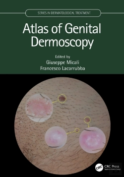 Bertrand.pt - Atlas Of Genital Dermoscopy