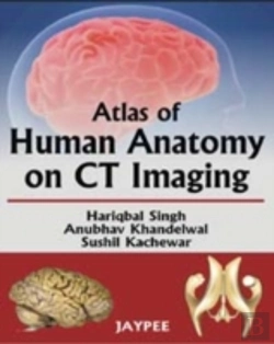 Bertrand.pt - Atlas Of Human Anatomy On Ct Imaging