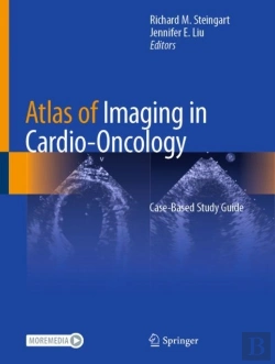 Bertrand.pt - Atlas Of Imaging In Cardio-Oncology