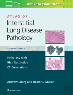 Bertrand.pt - Atlas Of Interstitial Lung Disease Pathology