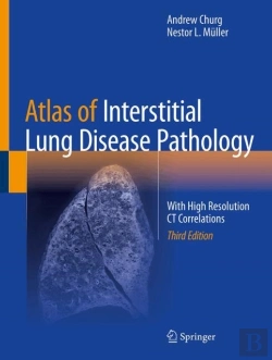 Bertrand.pt - Atlas Of Interstitial Lung Disease Pathology