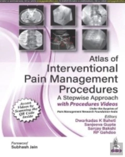 Bertrand.pt - Atlas Of Interventional Pain Management Procedures