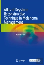 Atlas Of Keystone Reconstructive Technique In Melanoma Management