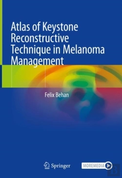 Bertrand.pt - Atlas Of Keystone Reconstructive Technique In Melanoma Management