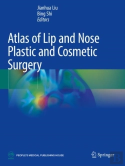 Bertrand.pt - Atlas Of Lip And Nose Plastic And Cosmetic Surgery