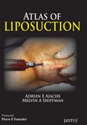 Atlas Of Liposuction
