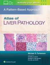 Atlas Of Liver Pathology: A Pattern-Based Approach