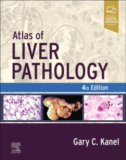 Bertrand.pt - Atlas Of Liver Pathology