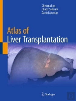 Bertrand.pt - Atlas Of Liver Transplantation