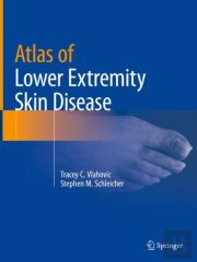 Atlas Of Lower Extremity Skin Disease