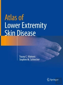 Bertrand.pt - Atlas Of Lower Extremity Skin Disease