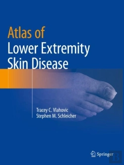 Bertrand.pt - Atlas Of Lower Extremity Skin Disease