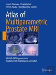 Atlas Of Multiparametric Prostate Mri