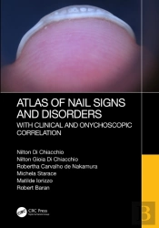 Atlas Of Nail Signs And Disorders With Clinical And Onychoscopic Correlation