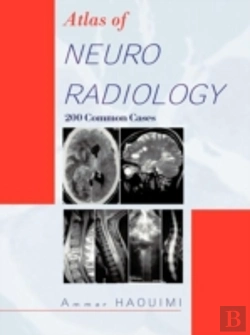 Bertrand.pt - Atlas Of Neuroradiology