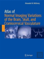 Atlas Of Normal Imaging Variations Of The Brain, Skull, And Craniocervical Vasculature