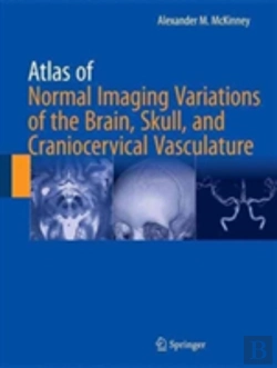 Bertrand.pt - Atlas Of Normal Imaging Variations Of The Brain, Skull, And Craniocervical Vasculature