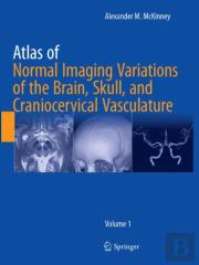 Atlas Of Normal Imaging Variations Of The Brain, Skull, And Craniocervical Vasculature