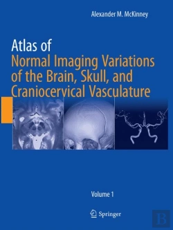 Bertrand.pt - Atlas Of Normal Imaging Variations Of The Brain, Skull, And Craniocervical Vasculature