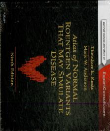 Atlas Of Normal Roentgen Variants That May Simulate Disease