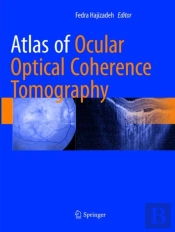 Atlas Of Ocular Optical Coherence Tomography