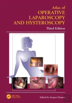 Bertrand.pt - Atlas Of Operative Laparoscopy And Hysteroscopy