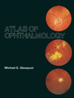 Bertrand.pt - Atlas Of Ophthalmology