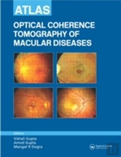 Bertrand.pt - Atlas Of Optical Coherence Tomography Of Macular Diseases