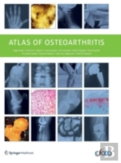 Atlas Of Osteoarthritis