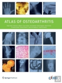 Bertrand.pt - Atlas Of Osteoarthritis