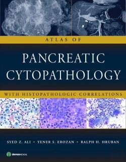 Bertrand.pt - Atlas Of Pancreatic Cytopathology