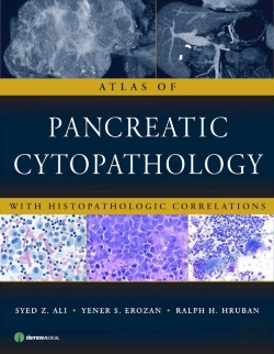 Bertrand.pt - Atlas Of Pancreatic Cytopathology With Histopathologic Correlations