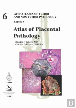 Bertrand.pt - Atlas Of Placental Pathology