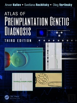 Bertrand.pt - Atlas Of Preimplantation Genetic Diagnosis