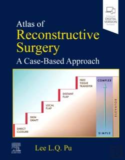 Bertrand.pt - Atlas Of Reconstructive Surgery: A Case-Based Approach