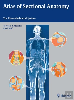 Bertrand.pt - Atlas Of Sectional Anatomy