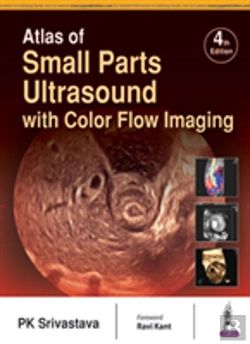 Bertrand.pt - Atlas Of Small Parts Ultrasound
