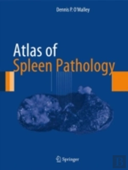 Bertrand.pt - Atlas Of Spleen Pathology