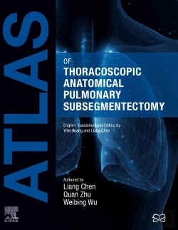 Bertrand.pt - Atlas Of Thoracoscopic Anatomical Pulmonary Subsegmentectomy