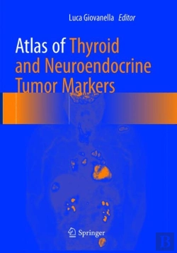 Bertrand.pt - Atlas Of Thyroid And Neuroendocrine Tumor Markers