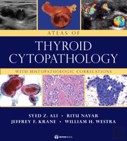 Bertrand.pt - Atlas Of Thyroid Cytopathology