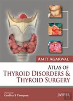 Bertrand.pt - Atlas Of Thyroid Disorders And Thyroid Surgery